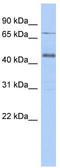Ubiquitin carboxyl-terminal hydrolase 12 antibody, TA333400, Origene, Western Blot image 