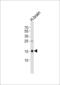 FXYD Domain Containing Ion Transport Regulator 6 antibody, 61-065, ProSci, Western Blot image 