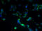 Zinc Finger DHHC-Type Containing 5 antibody, A61882-100, Epigentek, Immunofluorescence image 