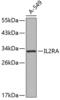 CD25 antibody, 18-894, ProSci, Western Blot image 