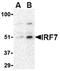 Interferon Regulatory Factor 7 antibody, AP05594PU-N, Origene, Western Blot image 