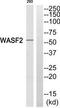 WASP Family Member 2 antibody, TA315025, Origene, Western Blot image 