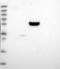 Coiled-Coil Domain Containing 71 antibody, NBP2-14600, Novus Biologicals, Western Blot image 