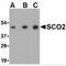 SCO Cytochrome C Oxidase Assembly Protein 2 antibody, MBS150350, MyBioSource, Western Blot image 