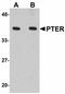 Phosphotriesterase Related antibody, LS-B4606, Lifespan Biosciences, Western Blot image 