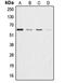 Akt antibody, orb213541, Biorbyt, Western Blot image 
