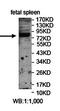 Zinc Finger Protein 544 antibody, orb78187, Biorbyt, Western Blot image 