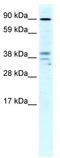 Zinc Finger CCCH-Type Containing 7B antibody, TA330574, Origene, Western Blot image 