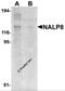NLR Family Pyrin Domain Containing 8 antibody, 5965, ProSci, Western Blot image 