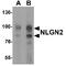 Neuroligin 2 antibody, TA349101, Origene, Western Blot image 