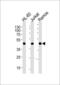 Major Histocompatibility Complex, Class I, B antibody, GTX81138, GeneTex, Western Blot image 