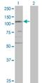 Structural Maintenance Of Chromosomes 3 antibody, H00009126-M02, Novus Biologicals, Western Blot image 