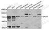 Dishevelled Binding Antagonist Of Beta Catenin 3 antibody, A8280, ABclonal Technology, Western Blot image 