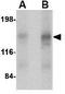 Calcium-dependent secretion activator 2 antibody, GTX85405, GeneTex, Western Blot image 