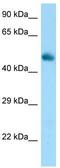 Fibroblast Growth Factor Receptor Substrate 3 antibody, TA344327, Origene, Western Blot image 