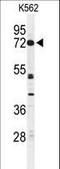 Cyclic Nucleotide Gated Channel Alpha 2 antibody, LS-C168874, Lifespan Biosciences, Western Blot image 