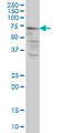 Calpain 5 antibody, LS-C196784, Lifespan Biosciences, Western Blot image 