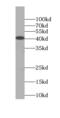 Ribosomal RNA Processing 36 antibody, FNab07499, FineTest, Western Blot image 