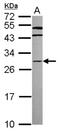 Homeobox protein Hox-C8 antibody, NBP2-16875, Novus Biologicals, Western Blot image 