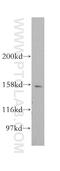 Centromere Protein J antibody, 11517-1-AP, Proteintech Group, Western Blot image 