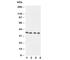 Annexin A8 antibody, R30573, NSJ Bioreagents, Western Blot image 