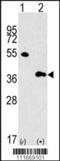MTOR Associated Protein, LST8 Homolog antibody, TA302160, Origene, Western Blot image 