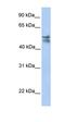 Mitochondrial tRNA-specific 2-thiouridylase 1 antibody, orb325420, Biorbyt, Western Blot image 