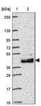 Leucine Rich Repeats And Transmembrane Domains 2 antibody, NBP2-30649, Novus Biologicals, Western Blot image 