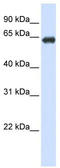 Solute Carrier Family 39 Member 4 antibody, TA333552, Origene, Western Blot image 