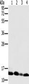 NADH:Ubiquinone Oxidoreductase Subunit S5 antibody, TA350214, Origene, Western Blot image 