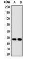 Nudix Hydrolase 6 antibody, LS-C668365, Lifespan Biosciences, Western Blot image 