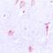 CTSE antibody, orb213807, Biorbyt, Immunohistochemistry paraffin image 