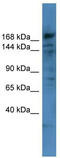 Collagen alpha-6(IV) chain antibody, TA342818, Origene, Western Blot image 