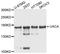 Uveal Autoantigen With Coiled-Coil Domains And Ankyrin Repeats antibody, A07252, Boster Biological Technology, Western Blot image 