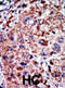 Phosphofructokinase, Liver Type antibody, abx033895, Abbexa, Immunohistochemistry paraffin image 