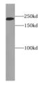 p210 antibody, FNab02789, FineTest, Western Blot image 