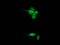 SPG7 Matrix AAA Peptidase Subunit, Paraplegin antibody, M04104-1, Boster Biological Technology, Immunofluorescence image 