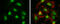 RB Binding Protein 8, Endonuclease antibody, GTX70264, GeneTex, Immunofluorescence image 
