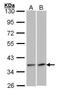 Vascular endothelial growth factor D antibody, GTX100805, GeneTex, Western Blot image 