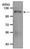 Amyloid Beta Precursor Protein antibody, PA5-17829, Invitrogen Antibodies, Immunoprecipitation image 