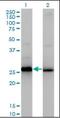 High mobility group protein B2 antibody, orb89623, Biorbyt, Western Blot image 