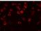Regulator Of Microtubule Dynamics 2 antibody, GTX85107, GeneTex, Immunofluorescence image 