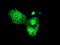 Proteasome 26S Subunit, Non-ATPase 3 antibody, TA504303, Origene, Immunofluorescence image 