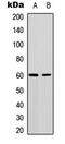 Akt antibody, MBS8229907, MyBioSource, Western Blot image 