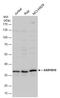Aldo-Keto Reductase Family 1 Member B10 antibody, GTX109571, GeneTex, Western Blot image 