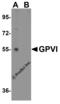 Platelet glycoprotein VI antibody, 4771, ProSci Inc, Western Blot image 