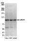 Leucine Rich Repeats And Calponin Homology Domain Containing 1 antibody, A304-909A, Bethyl Labs, Western Blot image 