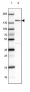 Phospholipase C Gamma 2 antibody, NBP1-87558, Novus Biologicals, Western Blot image 