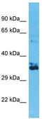 Olfactory Receptor Family 2 Subfamily W Member 3 antibody, TA337498, Origene, Western Blot image 