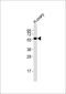 Dopamine Receptor D5 antibody, M03010, Boster Biological Technology, Western Blot image 